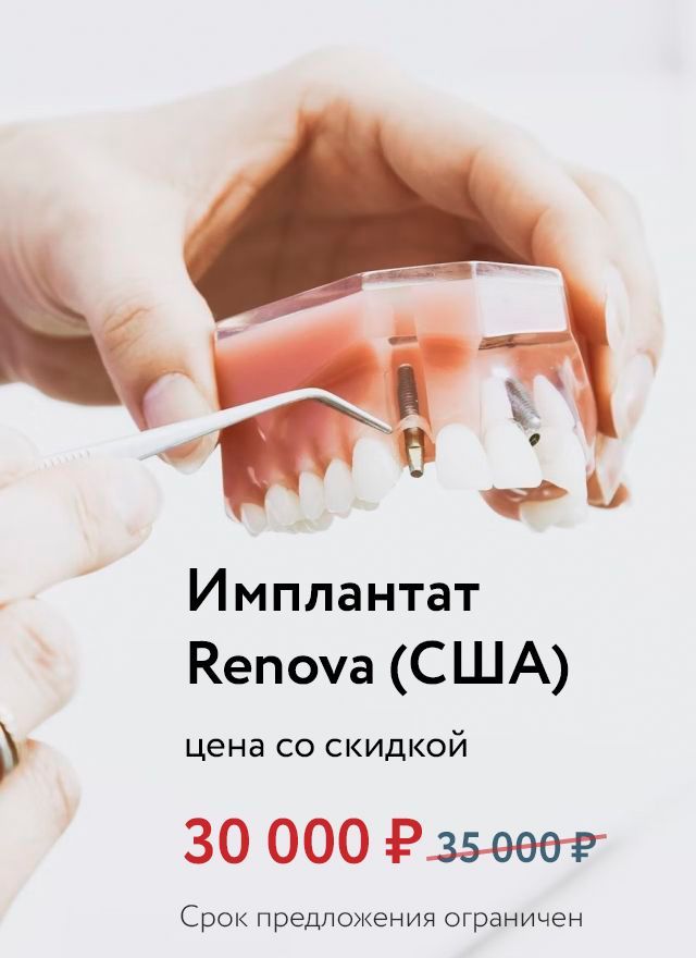 Скидка на имплантат Renova (США)